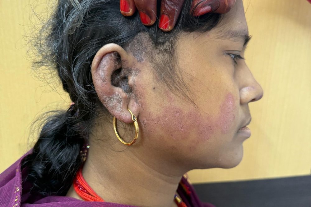 Connective Tissue & Autoimmune Diseases - Acord Clinic - Dr Akash Singh