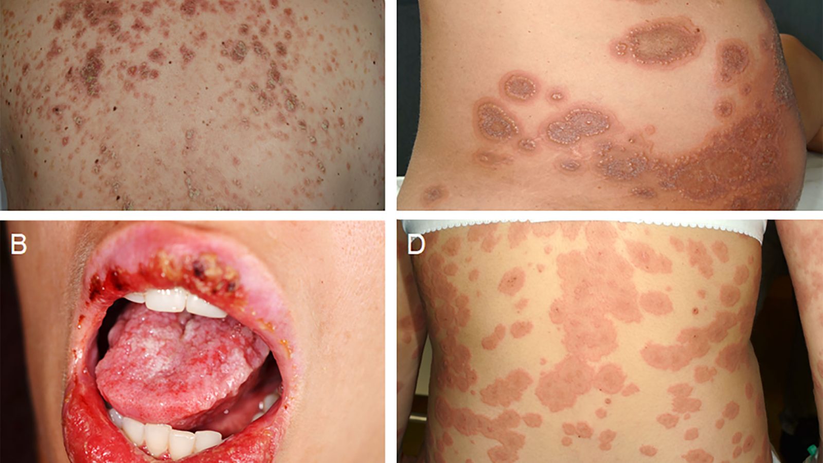 fphar-11-583354-g001