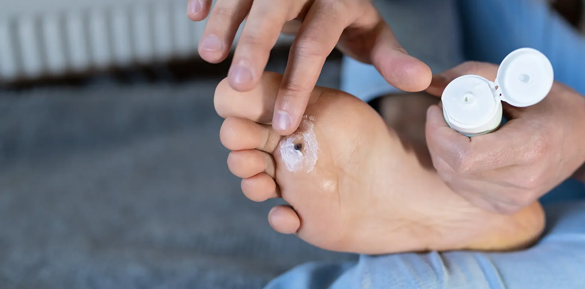 plantar-wart-treatment.jpg